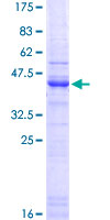 12.5% SDS-PAGE Stained with Coomassie Blue